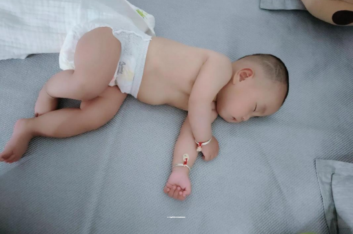 泗洪宝宝头上长痱子